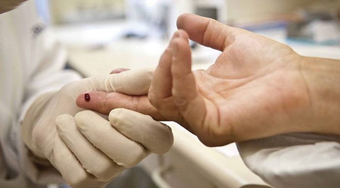 Prefeitura e Rotary realizam testes rápidos de hepatites