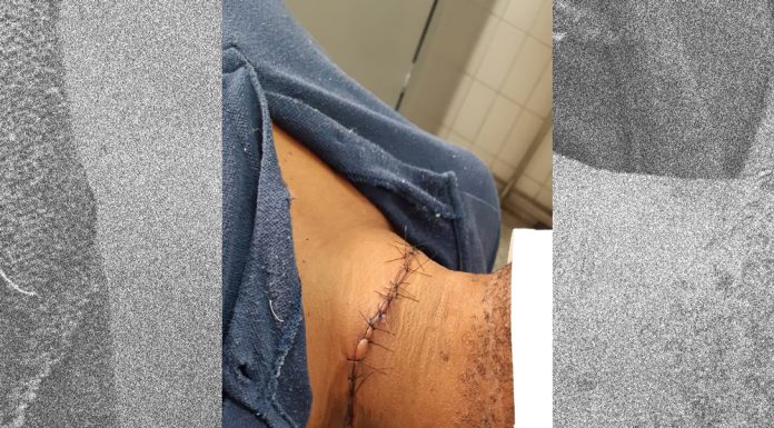 Homem é atingido por linha com cerol e tem ferimentos no pescoço